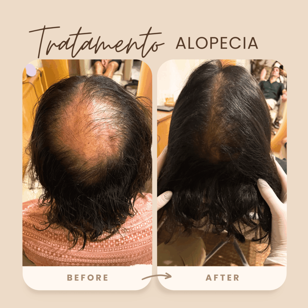 antes e depois 2