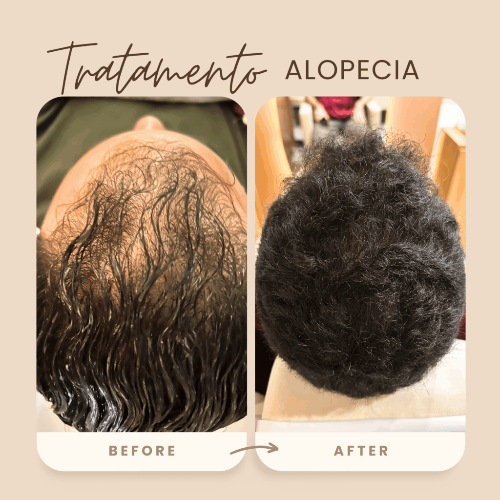 antes e depois 3