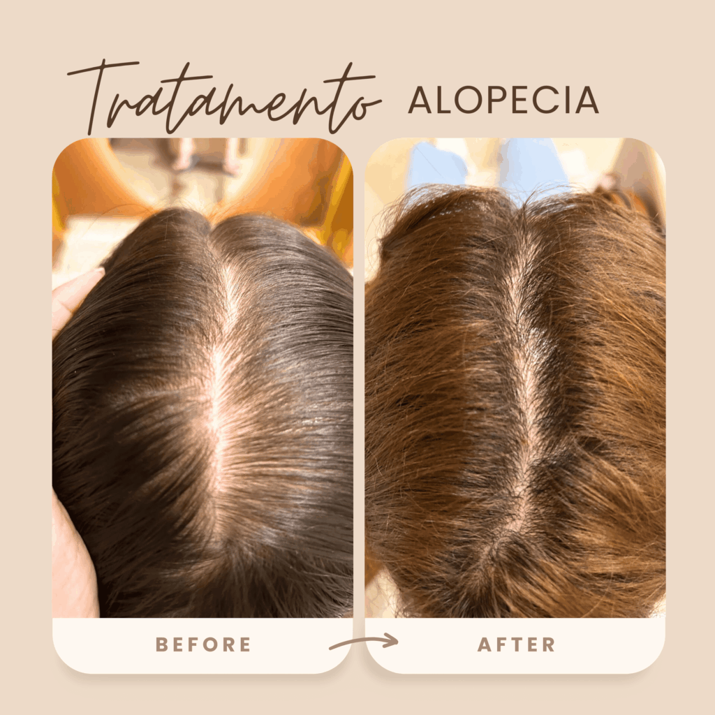 antes e depois 4