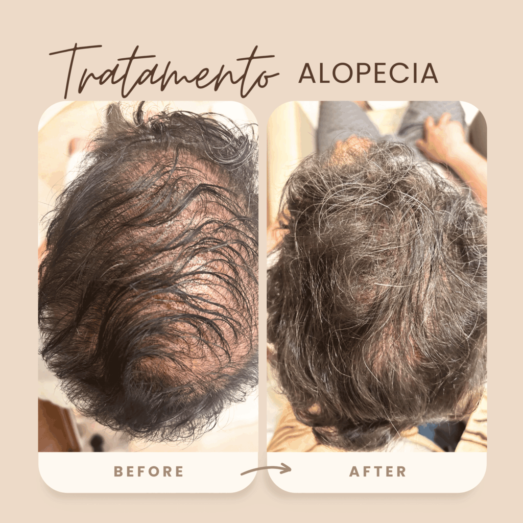 antes e depois 5