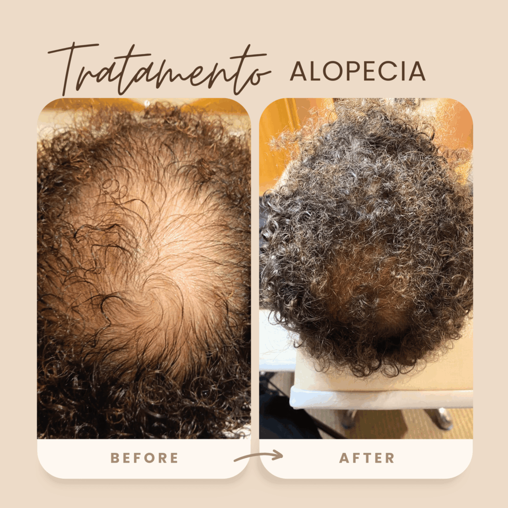 antes e depois 6